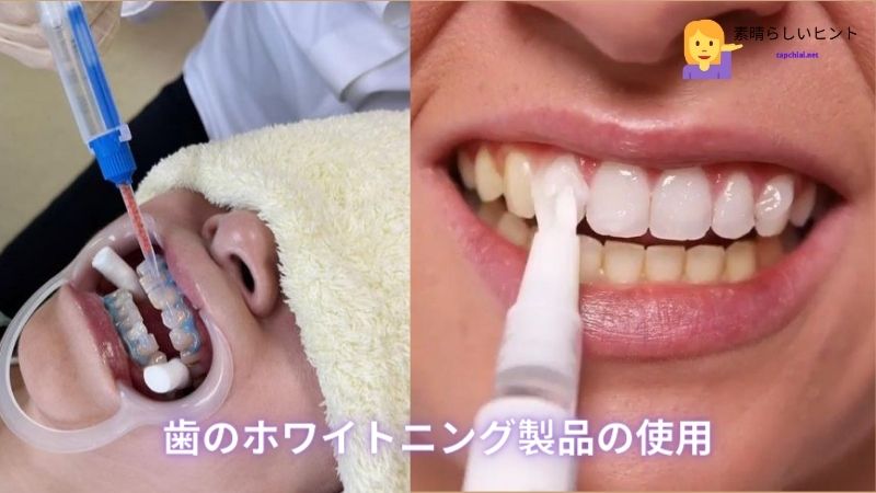 歯のホワイトニング製品の使用